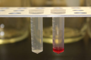 Optimized tissue collection to yield quality RNA for expression profiling