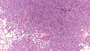 Pathological review of genetically modified mouse lung tissue