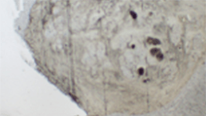 RNA extraction from FFPE tumor tissues